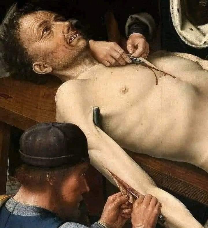 Foto Gump do dia – A pena de Sisamnes