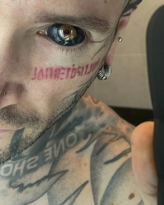 Scleral tattooing | Bizarro | cirurgia, curioso, estética, estranho