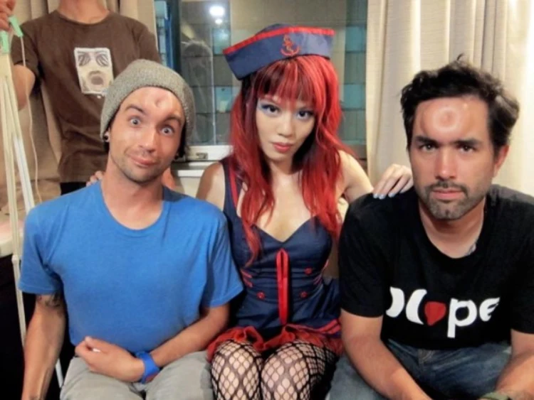 Bagel head procedure | Bizarro | cirurgia, curioso, estética, estranho