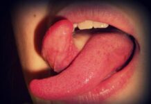 10 cirurgias plásticas inusitadas que as pessoas realmente fazem